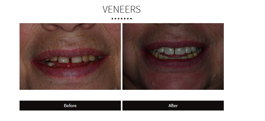 Demonstrating First-Hand Experience in YMYL Niches 1 image 20